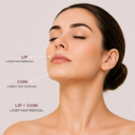 Lip + Chin Laser Hair Removal