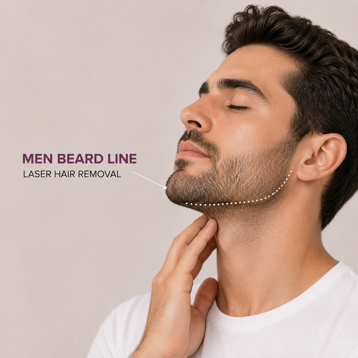 Men Beard Line Laser Hair Removal Services Men Beard Line Laser Hair Removal - Image 1
