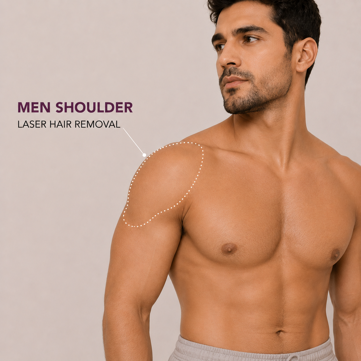 Men Shoulder Laser Hair Removal services Men Shoulder Laser Hair Removal - Image 1