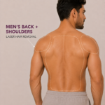 Men’s Back + Shoulders Laser Hair Removal