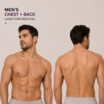 Men’s Chest + Back Laser Hair Removal