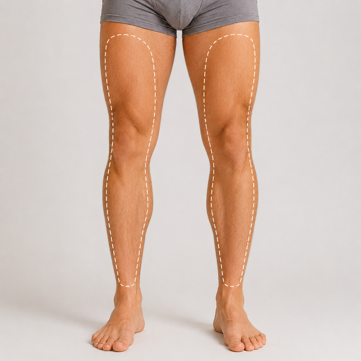 Mens Legs Laser Hair Removal Men’s Legs Laser Hair Removal - Image 1